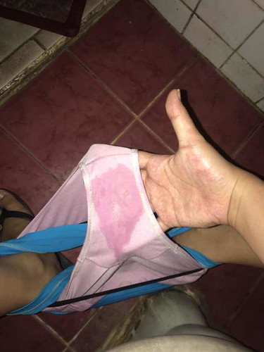 Eveprim or did my water already break/pop?