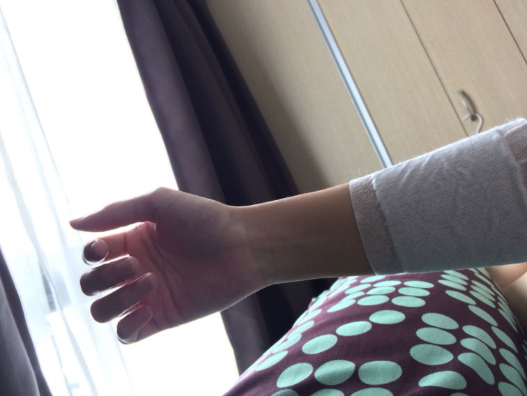 Mencegah carpal tunnel syndrome (CTS)