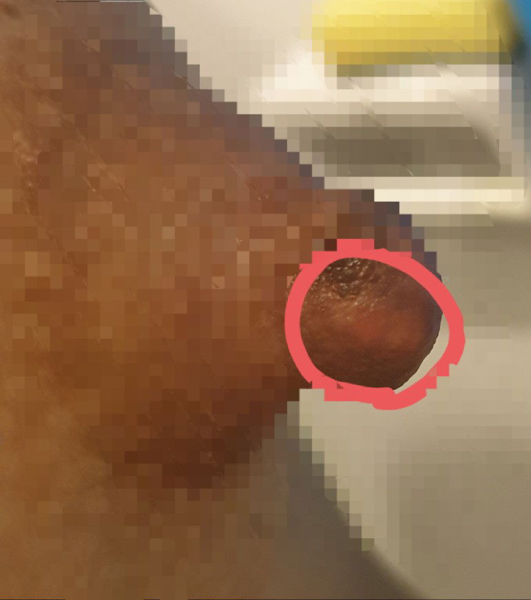 ไวท์ดอทหรือป่าว