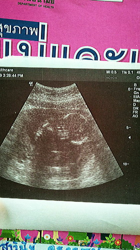 16วีคดูยังไงค่ะ