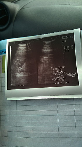 ลุงหมอบอกหนูเป็นผู้ชายแต่อีแม่ดูไม่เป้น555