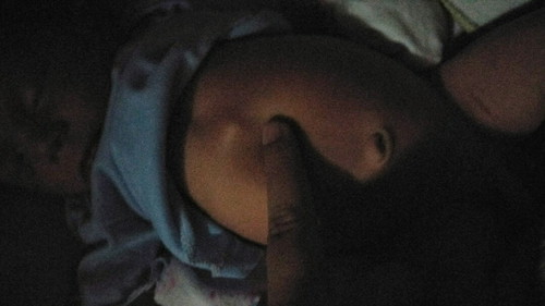 น้องมีก้อนๆแบบนี้ปกติไหมค่ะ