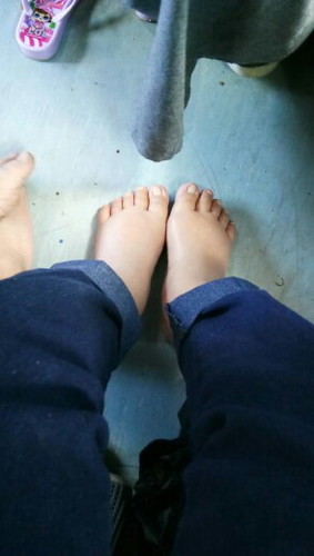 kaki bengkak