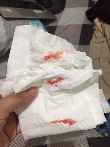 blood!