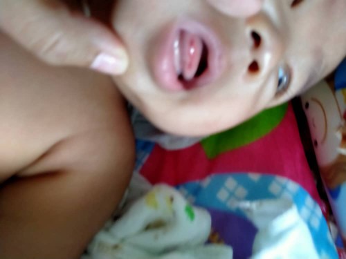 hujung lidah baby merah