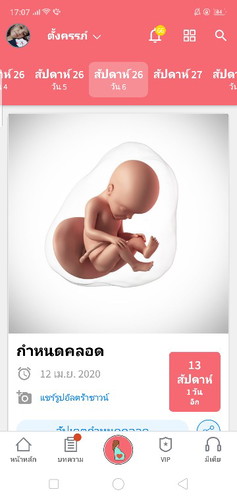 ปวดร้าวจิมิ