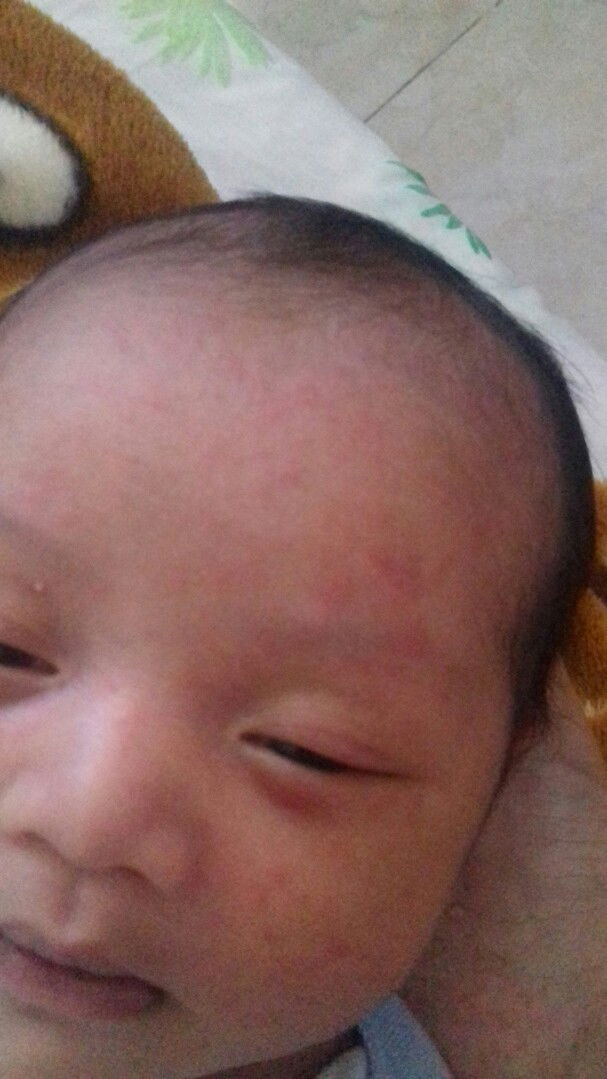Kulit bayi