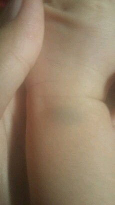 tanda biru keungu2an ditangan