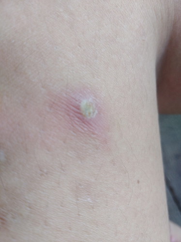 เป็นอะไรไม่รุ้