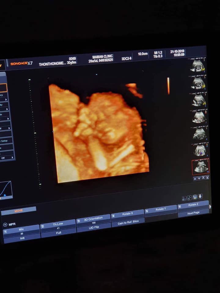 Paphawara Thontongmeesuk profile icon