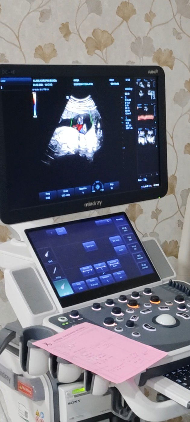 USG DI USIA KEHAMILAN 16 MUNGGU