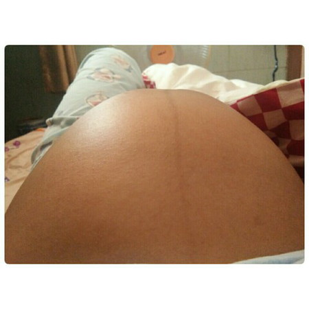 ท้องแบบนี้ญ.ช.ค้ะ