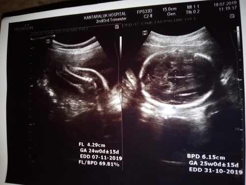 น้ำหนัก