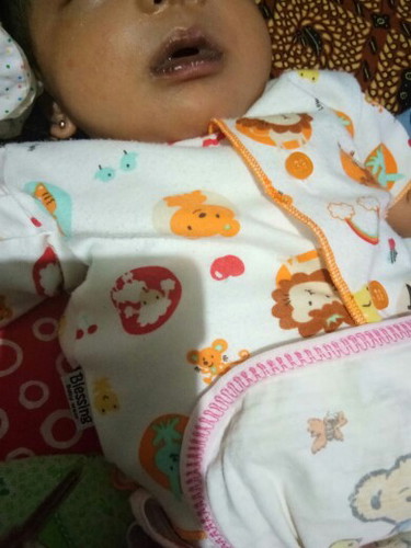 bibir hitam