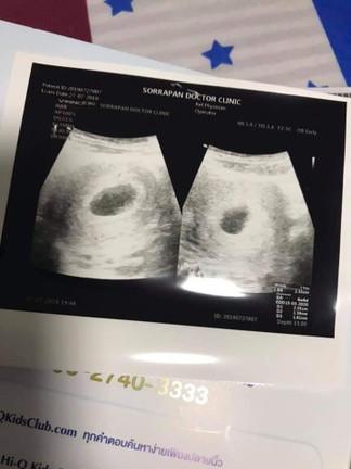 ซาวด์เจอน้องกี่ week ค่ะ เรา 6week6day ยังไม่เจอเลยค่ะ