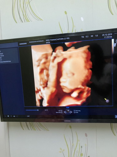 38 +1 week ?