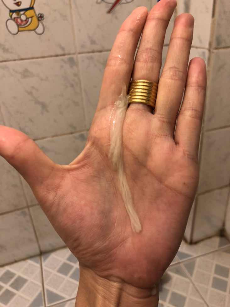 มูกหรือตกขาวค่ะ ไม่มีเลือดปน