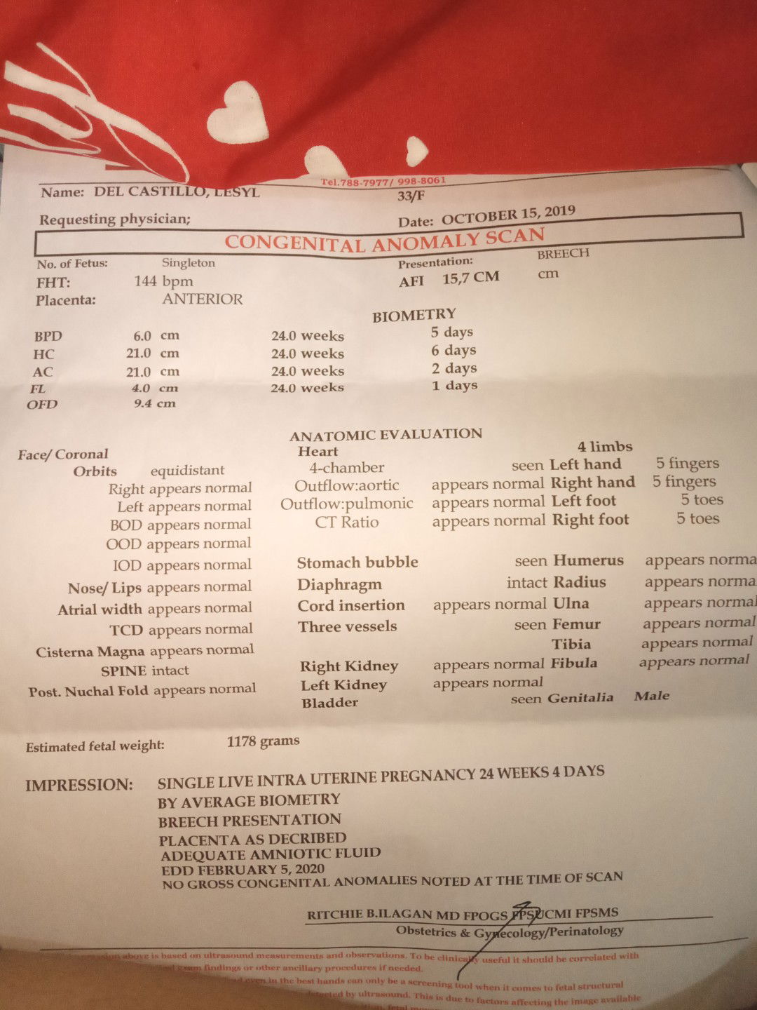 cas result.my wish granted baby boy.thanks god!