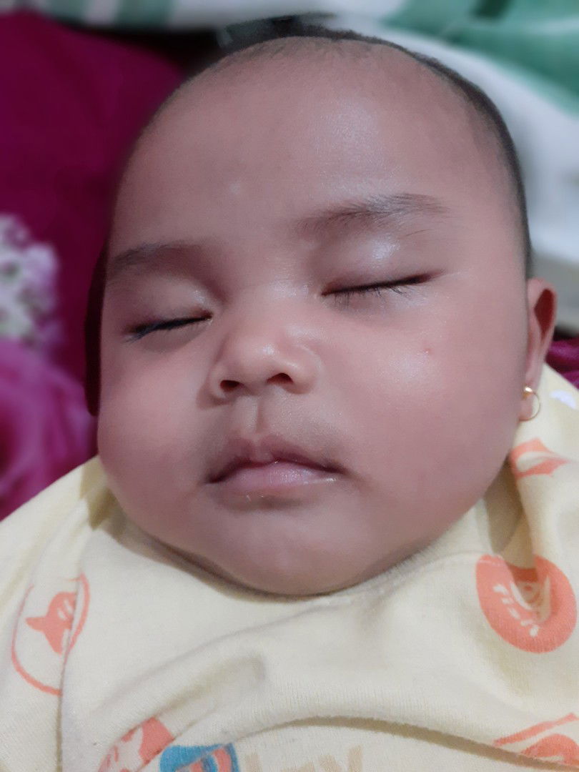 Putih2 di wajah karena ASI