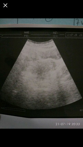 apakah ini baik2 saja saat usg belum kelihatan apa2 padahal usia kehamilan 7 minggu