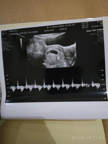6w5d