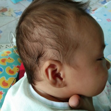 แบบนี้น้องหัวแบนมั้ยคะ ?