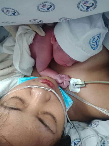 CS due to early Leak of Amniotic Fluid