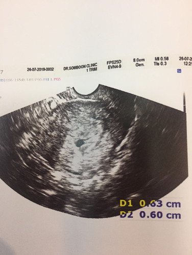 แม่ๆค่ะสอบถามทีนะค่ะ