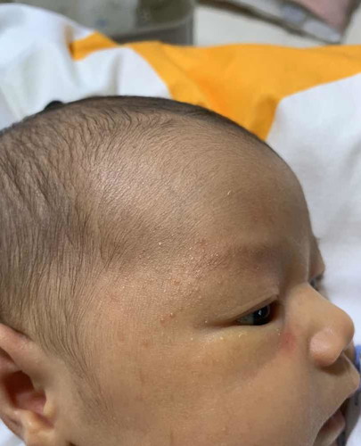 น้องอายุ 15 วัน เป็นผื่นแบบนี้ ใช้อะไรถึงจะหายคะ