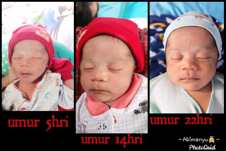 perubahan baby?
