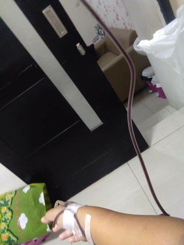 lebih baik Sc apa normal