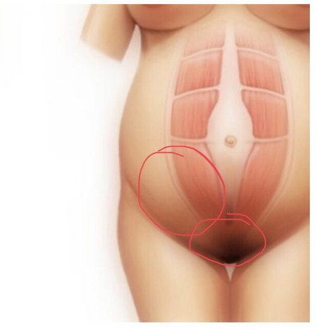 เจ็บตรงที่วง