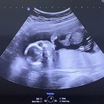 Natchawan Kerdwut profile icon