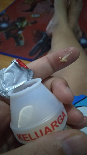 yakult