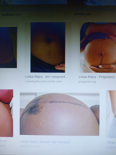 linea nigra