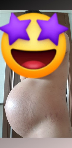 Stretchmarks