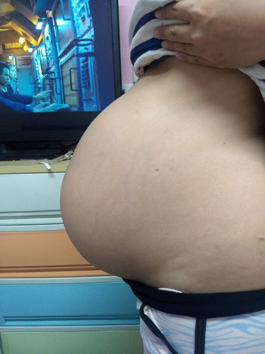 ตั้งครรภ์