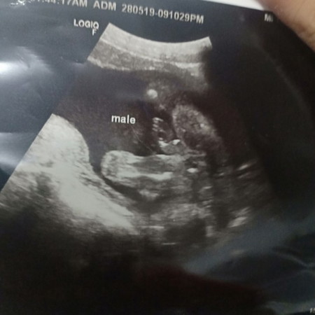 เเบบนี้ผู้หญิงหรือชายค่ะ