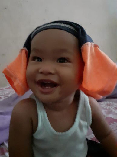 bayi sariawan
