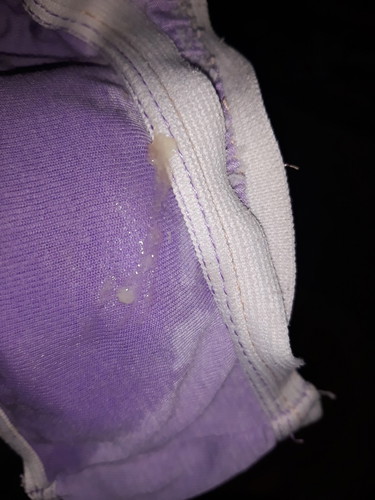 Mucus Plug ?
