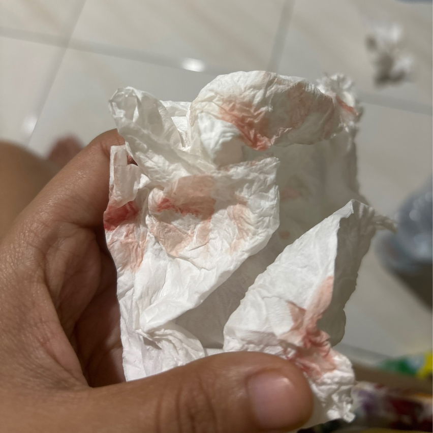 keluar bercak darah