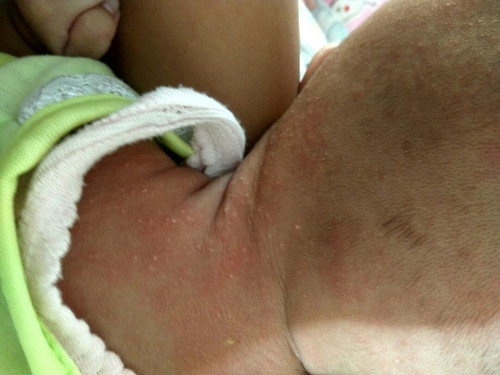 biang keringet apa bukan