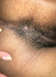 PLEASE I NEED ADVICE
