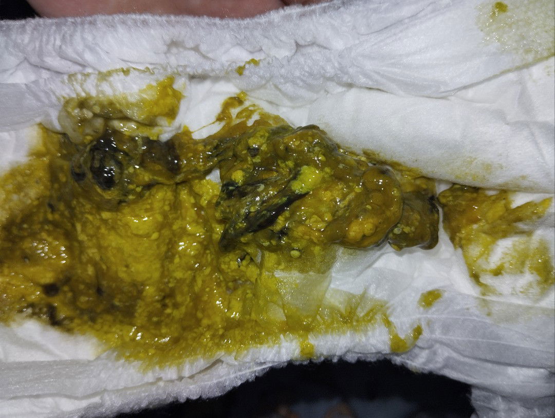 Mau tanya dong kalau pup sikecil berlendir hitam itu tanda apa ya