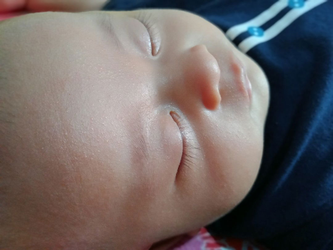 bintik bintik di wajah