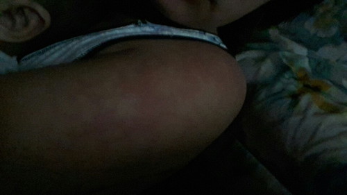 injectable