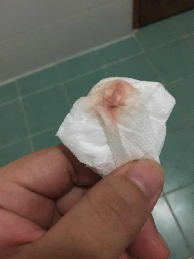 แบบนี้คืออะไรคะ❓อันตรายไหมคะ❓