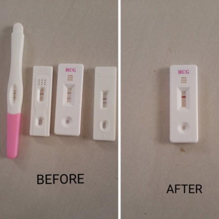 miscarriage. 6weeks