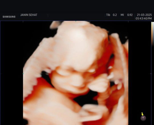 Rizka Novianti profile icon