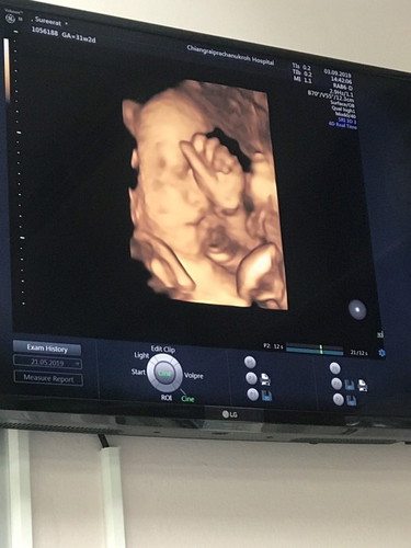 31+2 wks.